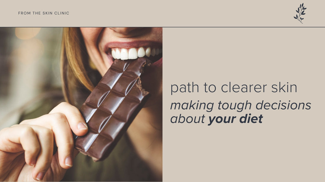 Giving Up Cheese and Chocolate: A Path to Clearer Skin